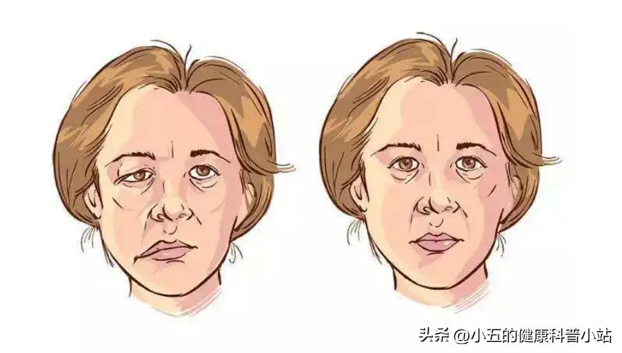 安眠药的深度解析，作用、影响及合理使用指南