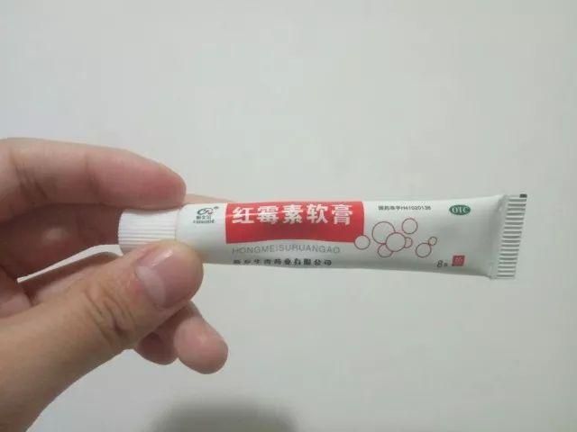 红霉素软膏治疗包皮炎详解，治疗细节与注意事项解析