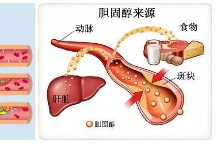 揭秘总胆固醇高的幕后黑手，健康警钟为你长鸣？